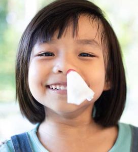 Child with tissue in her nose to stop a nose bleed